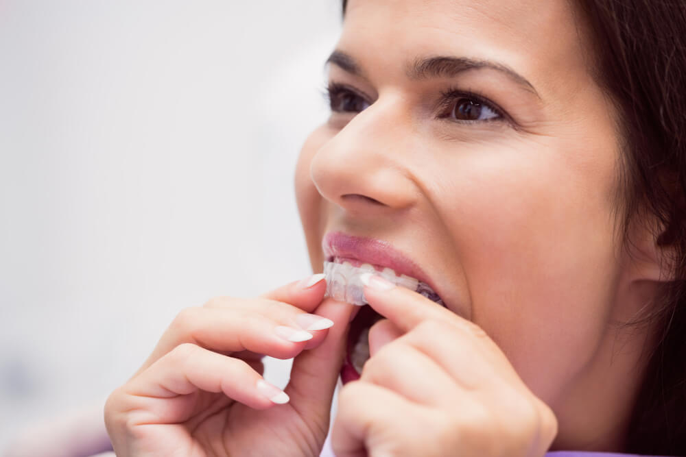 invisalign en jerez